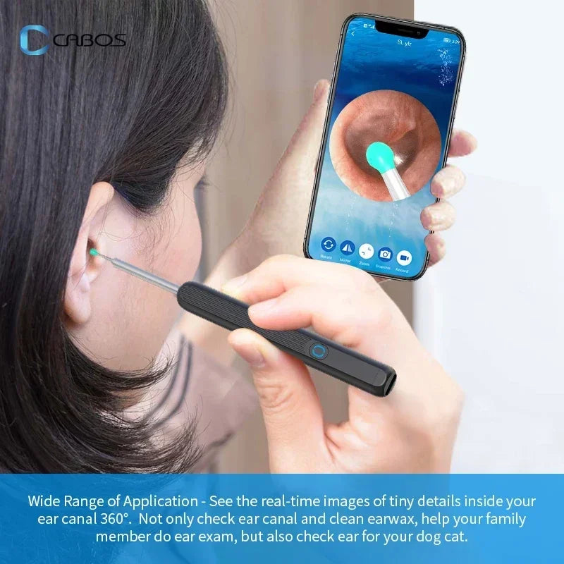Smart Visual Ear Cleaner HD Ear Sticks Otoscope USB C Charging Endoscope Wax Removal Tool Earpick Mini Camera HD Earpick Gifts