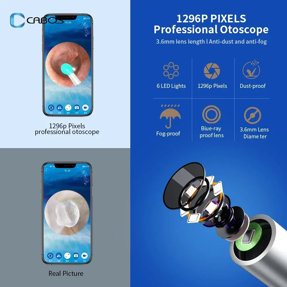 Smart Visual Ear Cleaner HD Ear Sticks Otoscope USB C Charging Endoscope Wax Removal Tool Earpick Mini Camera HD Earpick Gifts
